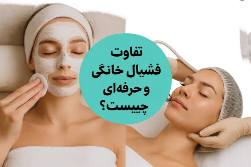 تفاوت فشیال خانگی و حرفه‌ای چیست؟