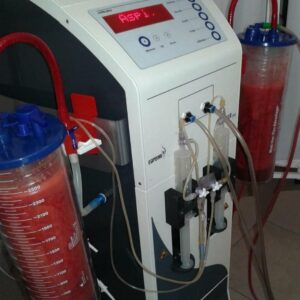 لیپوماتیک پیکرتراشی لاغری ژنیکوماستی تزریق ژل چربی